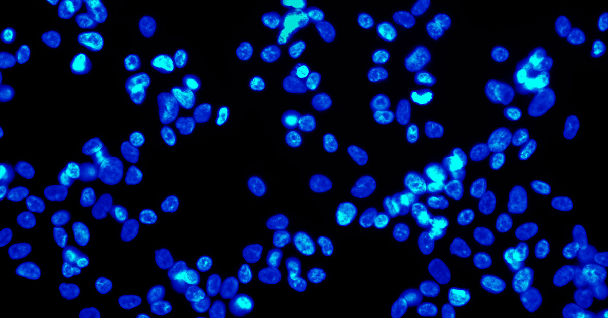 /globalassets/tvs/learn/iis/cells-under-microscope-1200x628.jpg