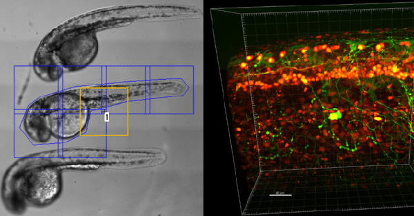 Super-Resolution Spinning Disk Confocal | Teledyne Vision Solutions