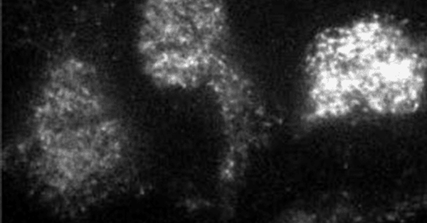 Turf Micropscopy TIRF Microscopy at the University of Pittsburgh | Teledyne Vision Solutions