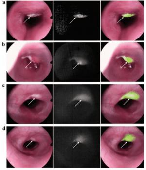 In Vivo Fluorescence Imaging-2.png