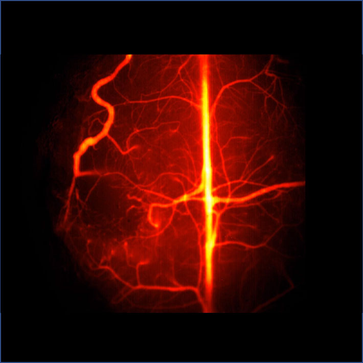 SWIR-angiography-image-intravital-imaging-of-brain-vasculator-using-SWIR-QDs.jpg